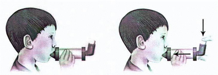 Image removed.